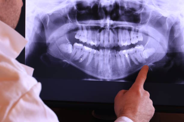 Best Emergency Dental Care for Broken or Chipped Teeth in Crystal Lawns, IL