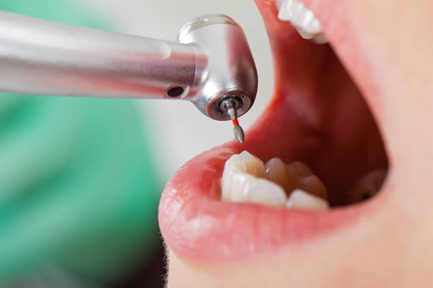 Best Emergency Treatment for Dental Infections or Abscesses in Crystal Lawns, IL